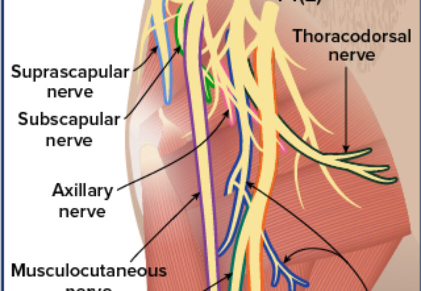 canine_Brachial Plexus_brachial_plexus_closeup_2